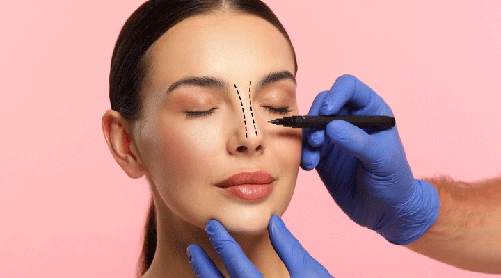 rhinoplasty